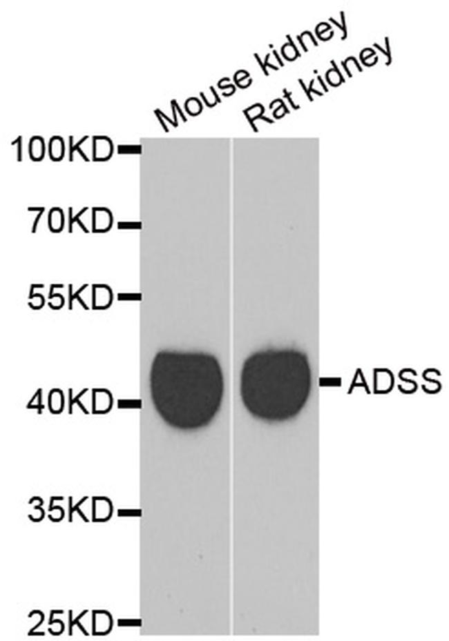 GATM Antibody in Western Blot (WB)