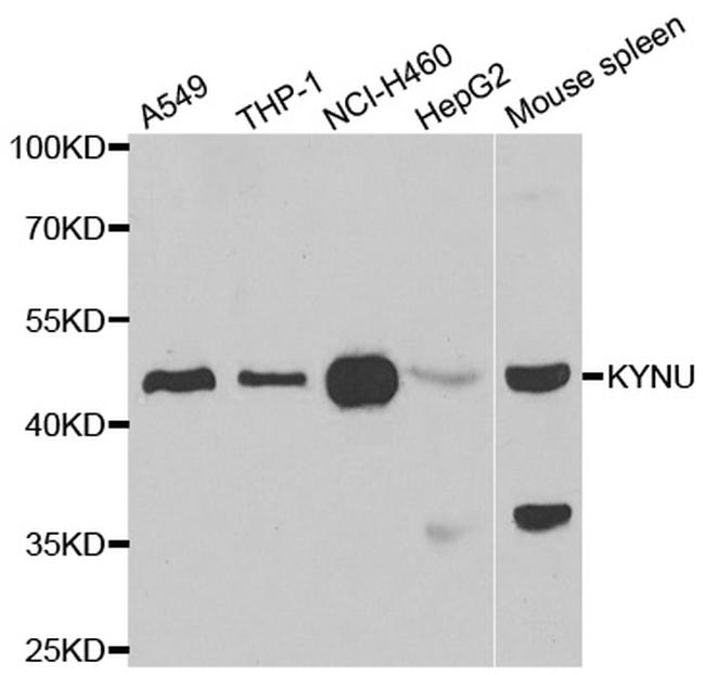 KYNU Antibody in Western Blot (WB)