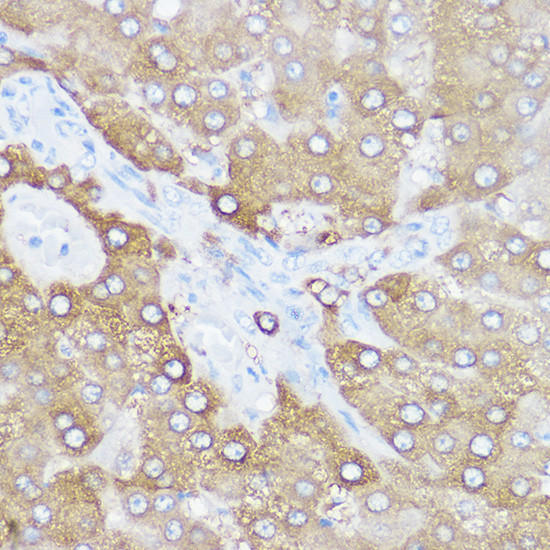 Monoacylglycerol Lipase Antibody in Immunohistochemistry (Paraffin) (IHC (P))