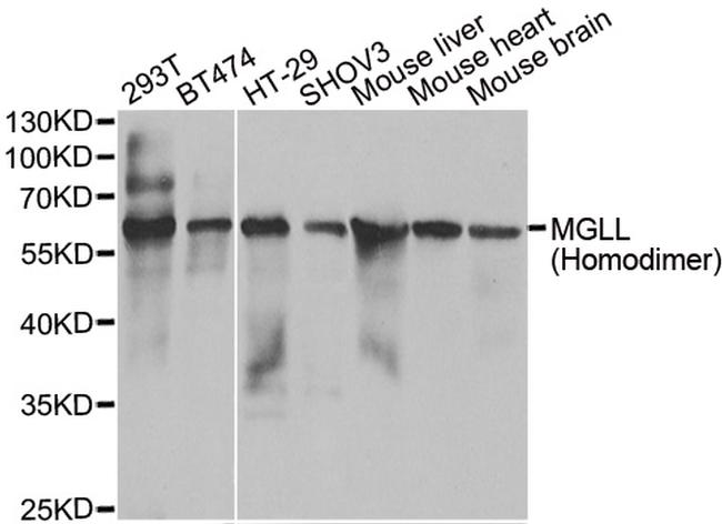 Monoacylglycerol Lipase Antibody in Western Blot (WB)