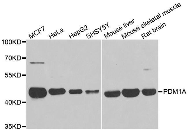 PPM1A Antibody in Western Blot (WB)