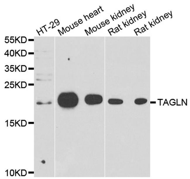 TAGLN Antibody in Western Blot (WB)