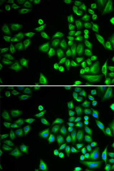 PTP1B Antibody in Immunocytochemistry (ICC/IF)