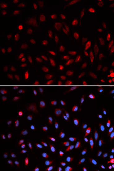 ERCC1 Antibody in Immunocytochemistry (ICC/IF)