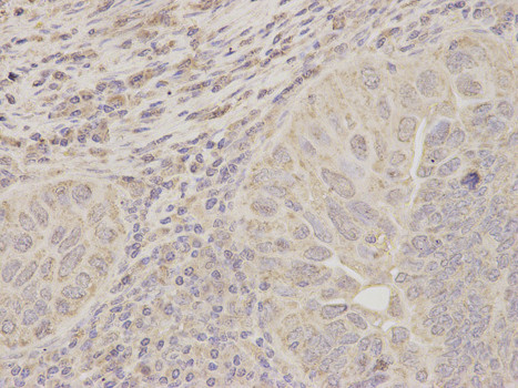 ACAT1 Antibody in Immunohistochemistry (Paraffin) (IHC (P))