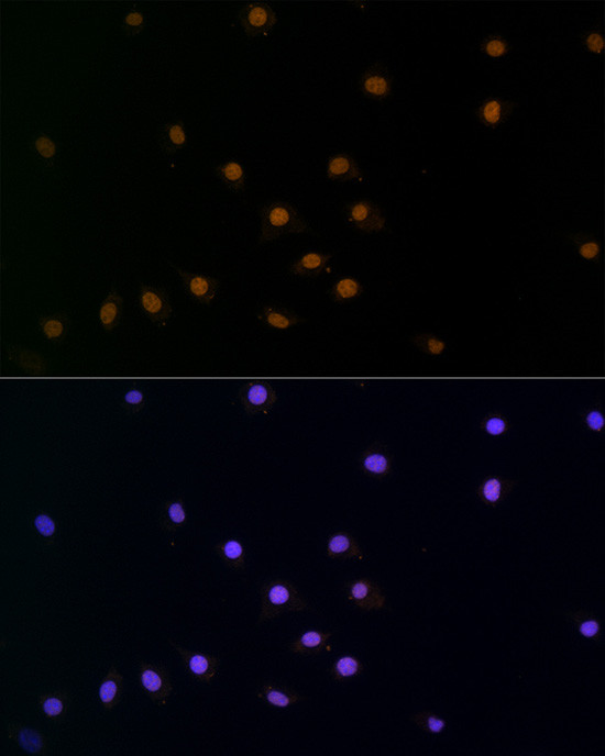 SNAIL Antibody in Immunocytochemistry (ICC/IF)