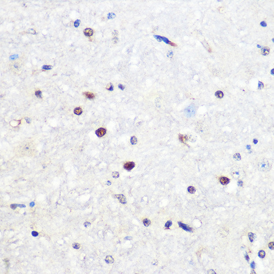 SNAIL Antibody in Immunohistochemistry (Paraffin) (IHC (P))