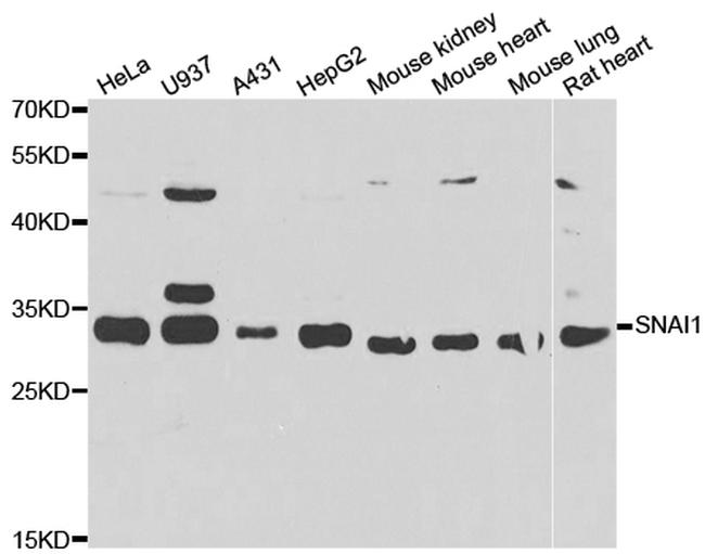 SNAIL Antibody in Western Blot (WB)