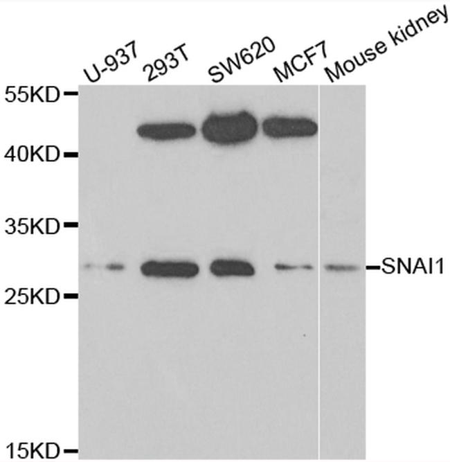 SNAIL Antibody in Western Blot (WB)