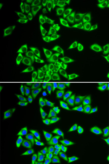 DDX3 Antibody in Immunocytochemistry (ICC/IF)