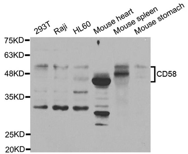 CD58 Antibody in Western Blot (WB)