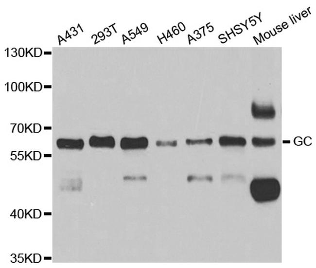 DBP Antibody in Western Blot (WB)