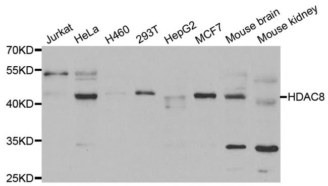 HDAC8 Antibody in Western Blot (WB)