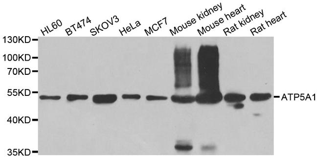 ATP5A1 Antibody in Western Blot (WB)