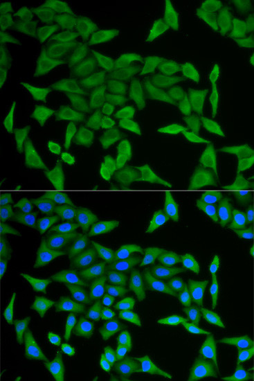 CRABP2 Antibody in Immunocytochemistry (ICC/IF)