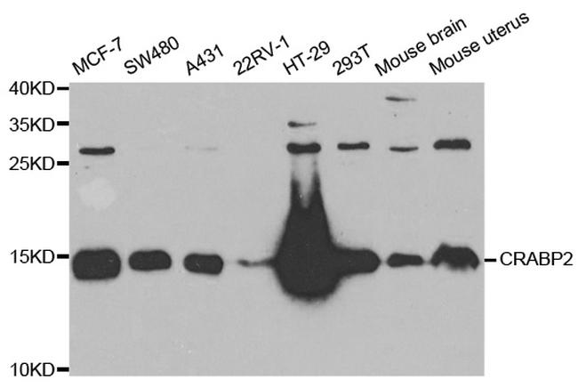 CRABP2 Antibody in Western Blot (WB)