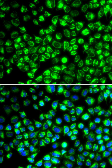 ATP6IP2 Antibody in Immunocytochemistry (ICC/IF)