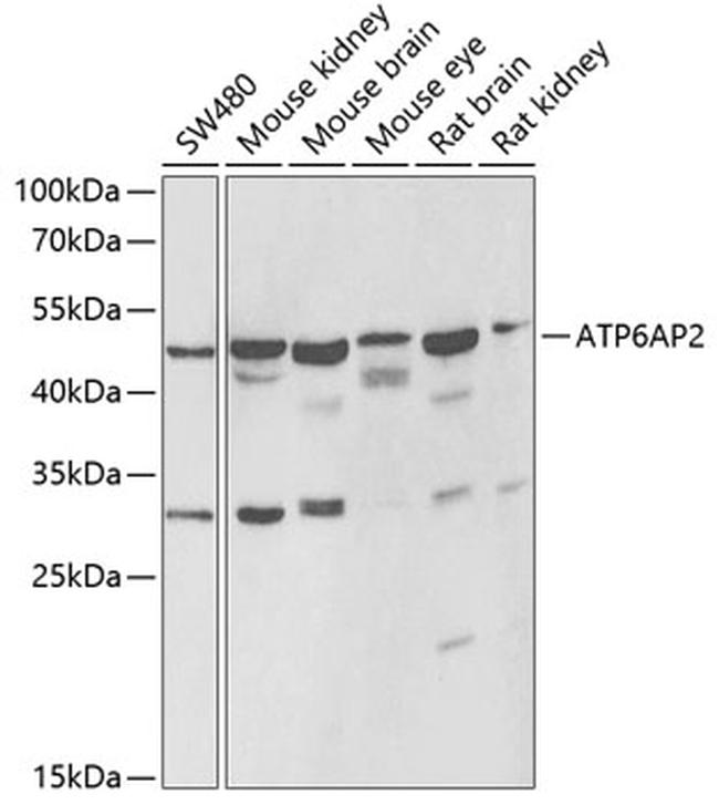 ATP6IP2 Antibody in Western Blot (WB)