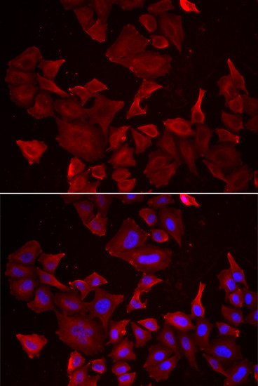 Caspase 14 Antibody in Immunocytochemistry (ICC/IF)