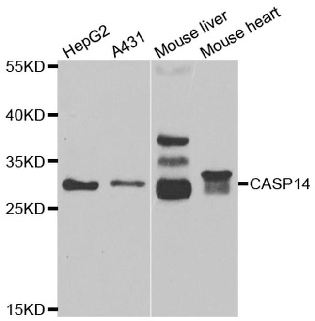 Caspase 14 Antibody in Western Blot (WB)