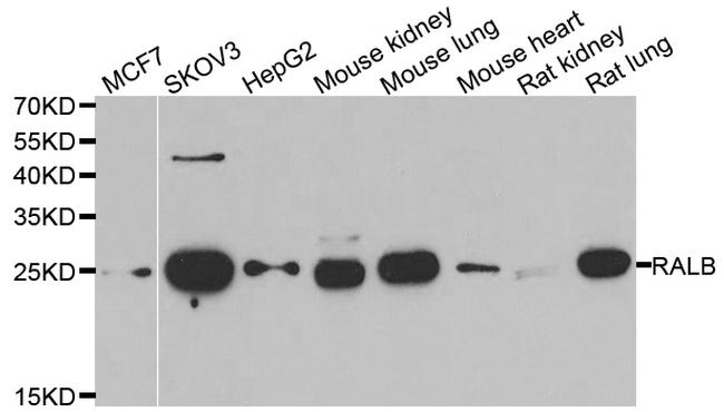 RALB Antibody in Western Blot (WB)