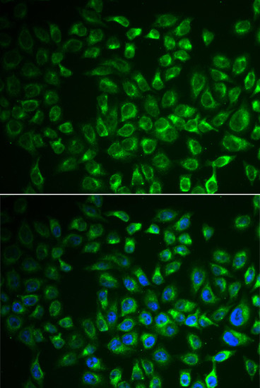 FABP6 Antibody in Immunocytochemistry (ICC/IF)