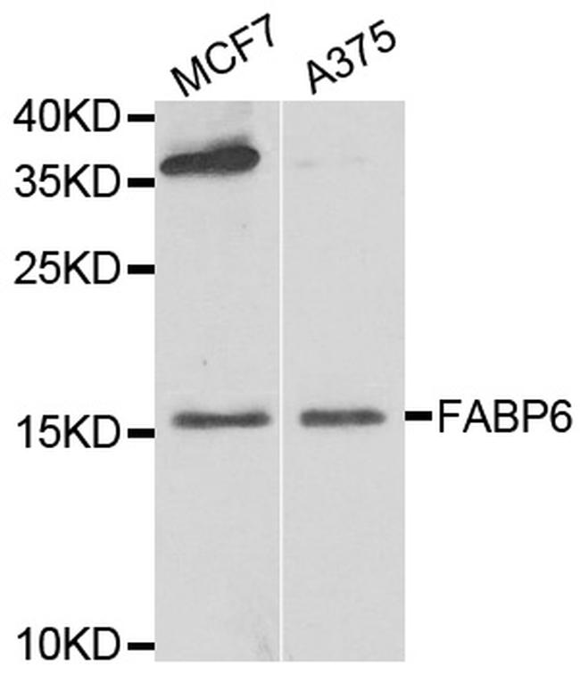 FABP6 Antibody in Western Blot (WB)