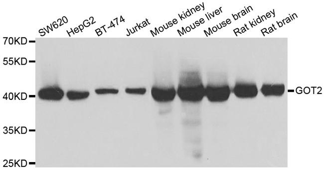 GOT2 Antibody in Western Blot (WB)