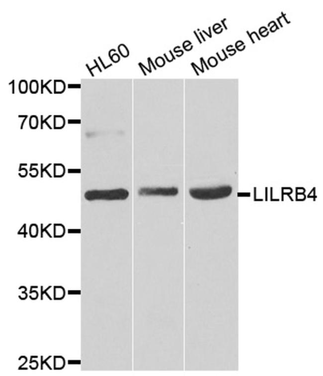 LILRB4 Antibody in Western Blot (WB)