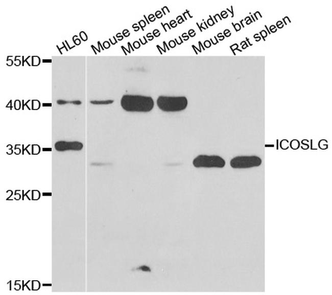 CD275 (B7-H2) Antibody in Western Blot (WB)