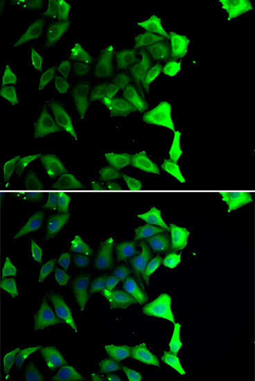 NDE1 Antibody in Immunocytochemistry (ICC/IF)