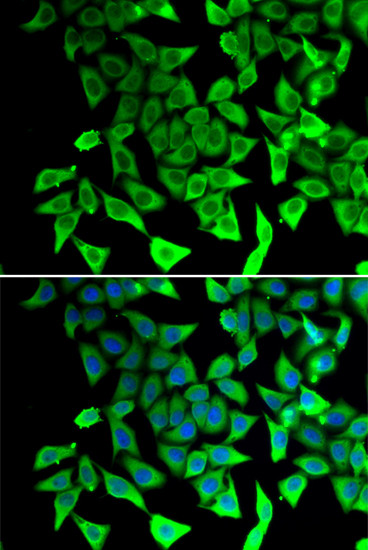 PTGES2 Antibody in Immunocytochemistry (ICC/IF)