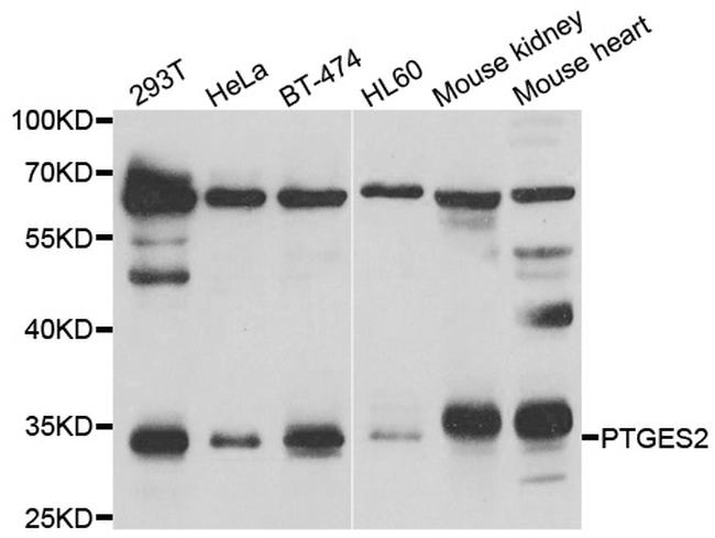 PTGES2 Antibody in Western Blot (WB)