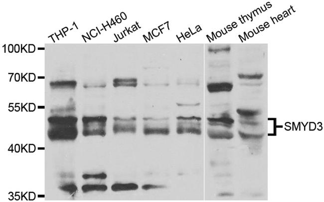 SMYD3 Antibody in Western Blot (WB)