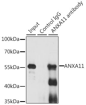 Annexin A11 Antibody in Immunoprecipitation (IP)