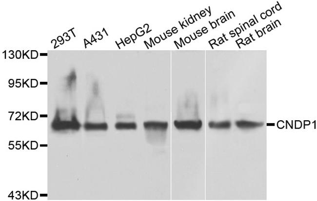 CNDP1 Antibody in Western Blot (WB)