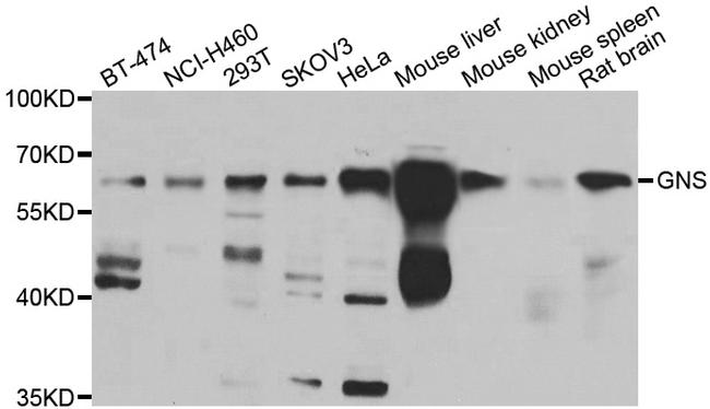 GNS Antibody in Western Blot (WB)