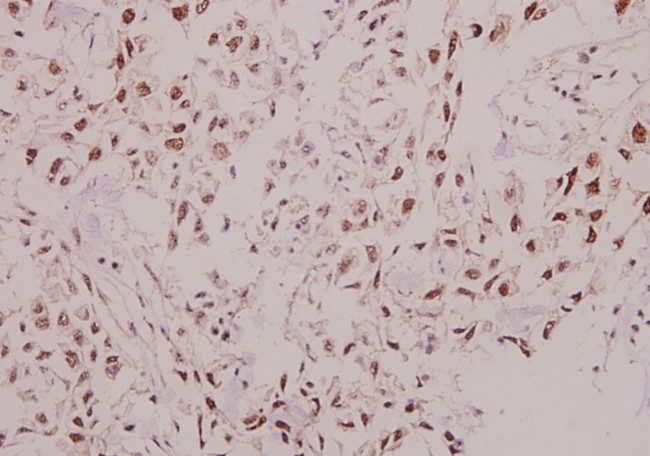 p57 Kip2 Antibody in Immunohistochemistry (Paraffin) (IHC (P))