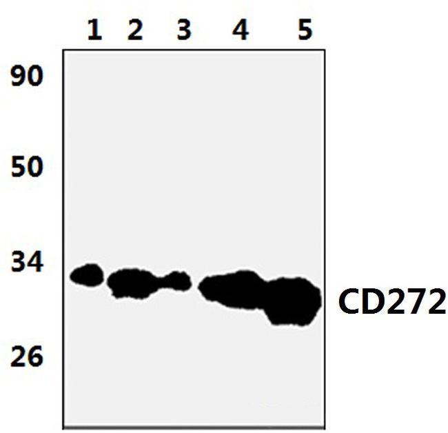 BTLA Antibody in Western Blot (WB)