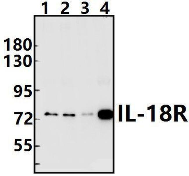 IL18R1 Antibody in Western Blot (WB)