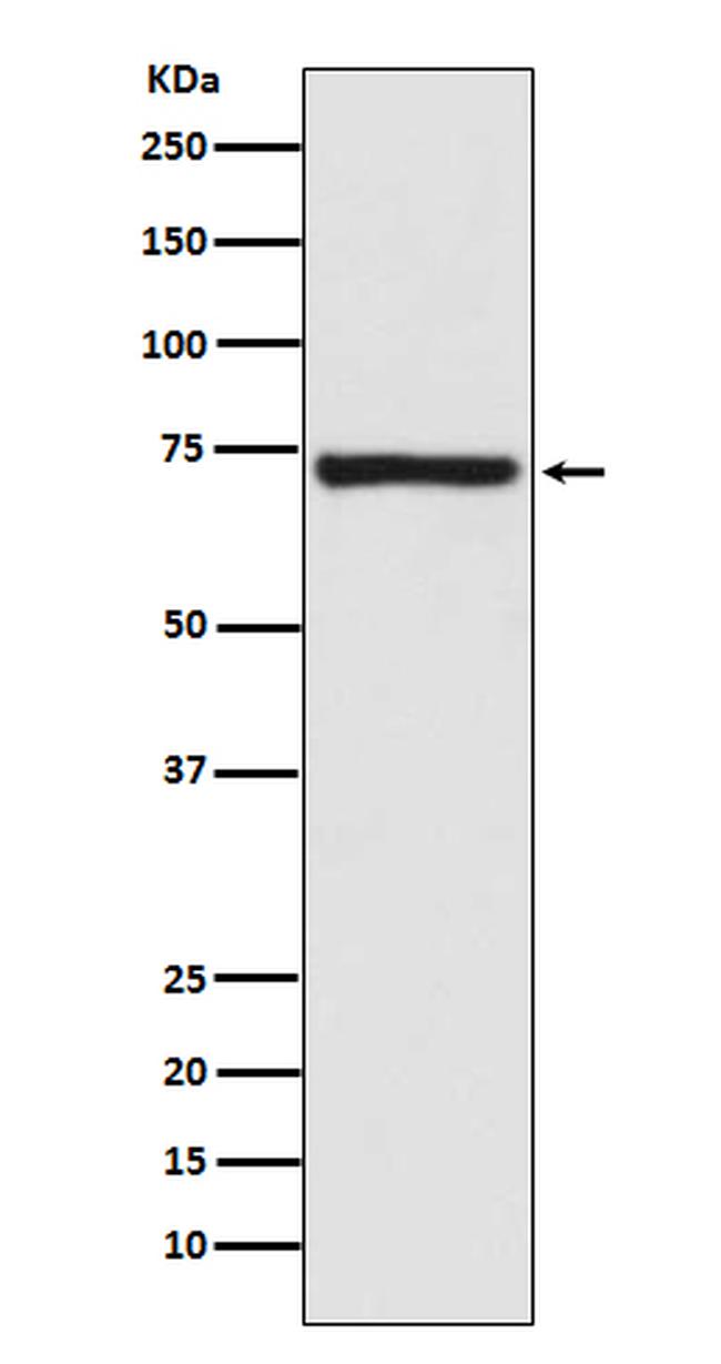 Mu-Calpain Antibody in Western Blot (WB)