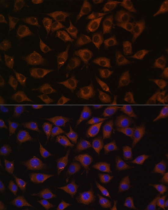 Prohibitin Antibody in Immunocytochemistry (ICC/IF)