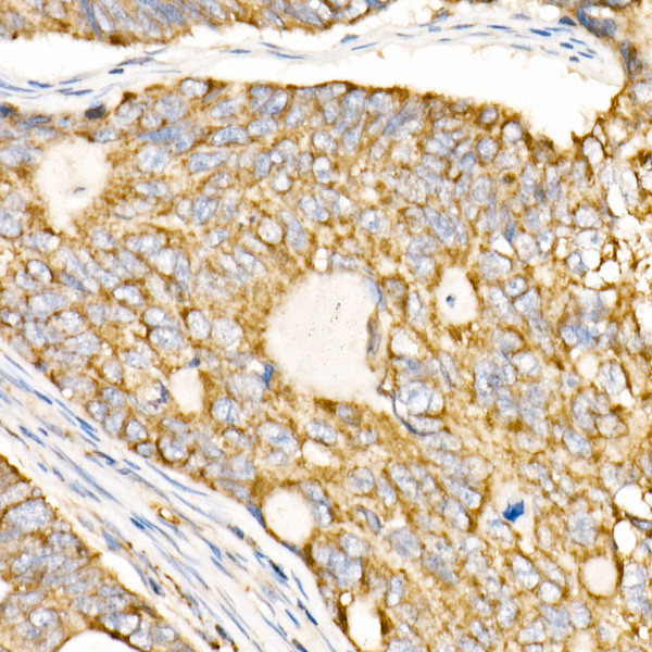 Prohibitin Antibody in Immunohistochemistry (Paraffin) (IHC (P))