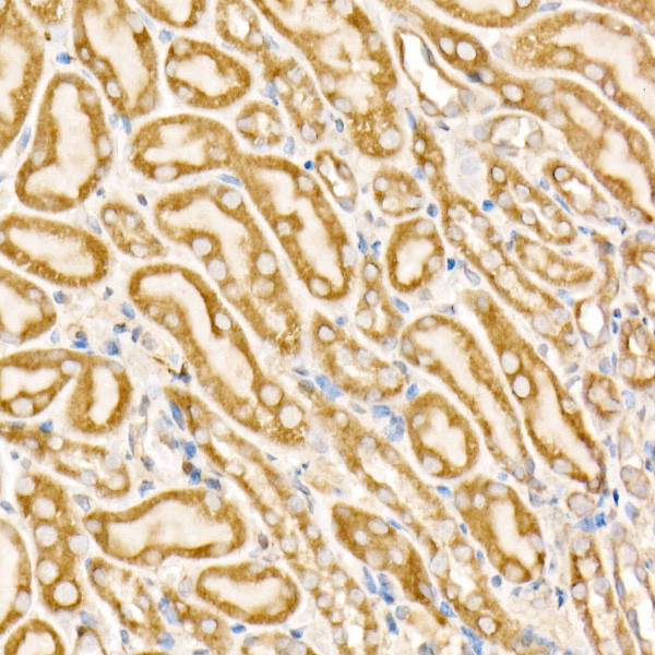 Prohibitin Antibody in Immunohistochemistry (Paraffin) (IHC (P))