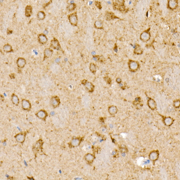 Prohibitin Antibody in Immunohistochemistry (Paraffin) (IHC (P))