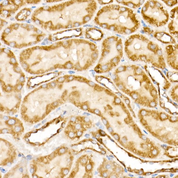 Prohibitin Antibody in Immunohistochemistry (Paraffin) (IHC (P))