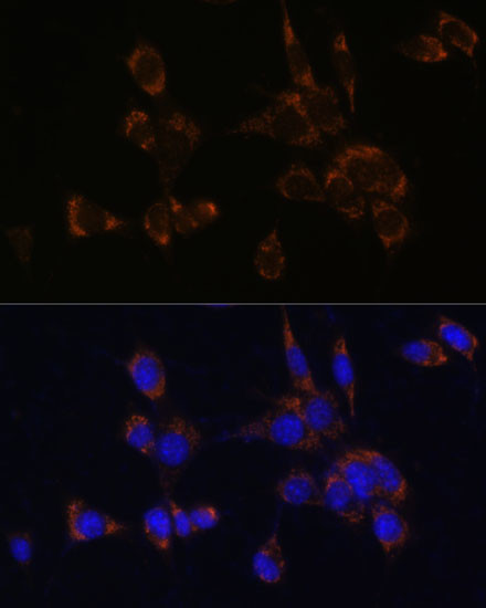 Perforin Antibody in Immunocytochemistry (ICC/IF)