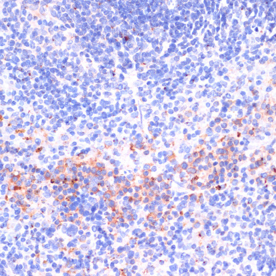 Perforin Antibody in Immunohistochemistry (Paraffin) (IHC (P))