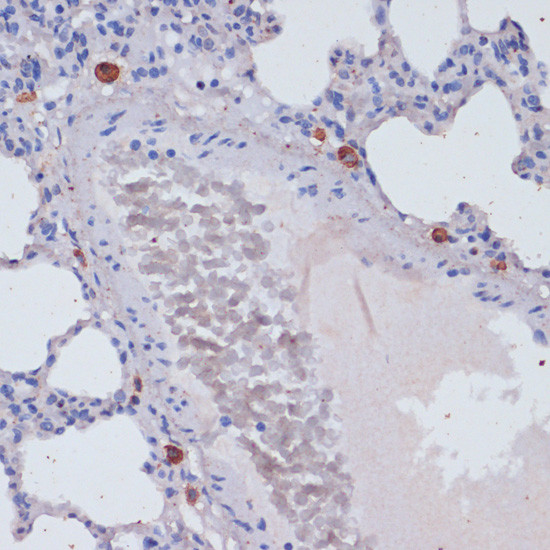 Perforin Antibody in Immunohistochemistry (Paraffin) (IHC (P))