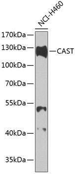 Calpastatin Antibody in Western Blot (WB)